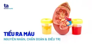 Cách Làm Món Từ Kỳ Đà Ngon Miệng: Hướng Dẫn Chi Tiết Từ A Đến Z