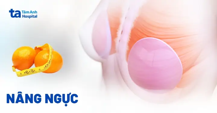 Hướng Dẫn Quy Trình Phẫu Thuật Nâng Ngực Toàn Diện