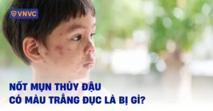 Đậu Trắng Là Đậu Gì? Tổng Tập Mọi Thông Tin Cần Biết