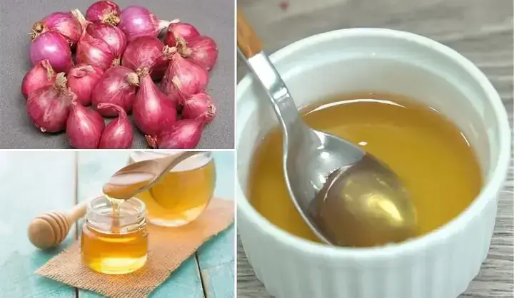 Hành Tím Trộn Mật Ong